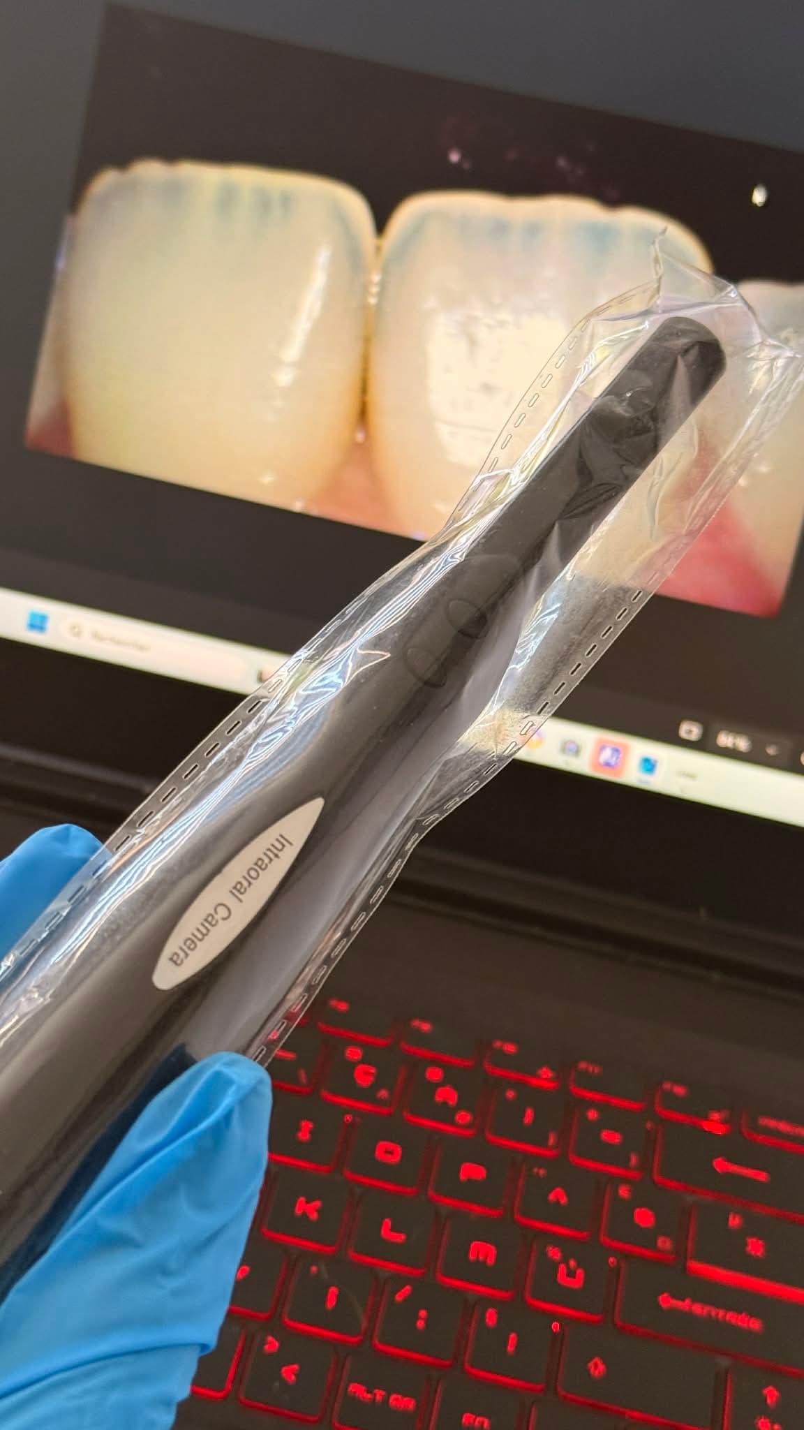 Chirurgie parodontale