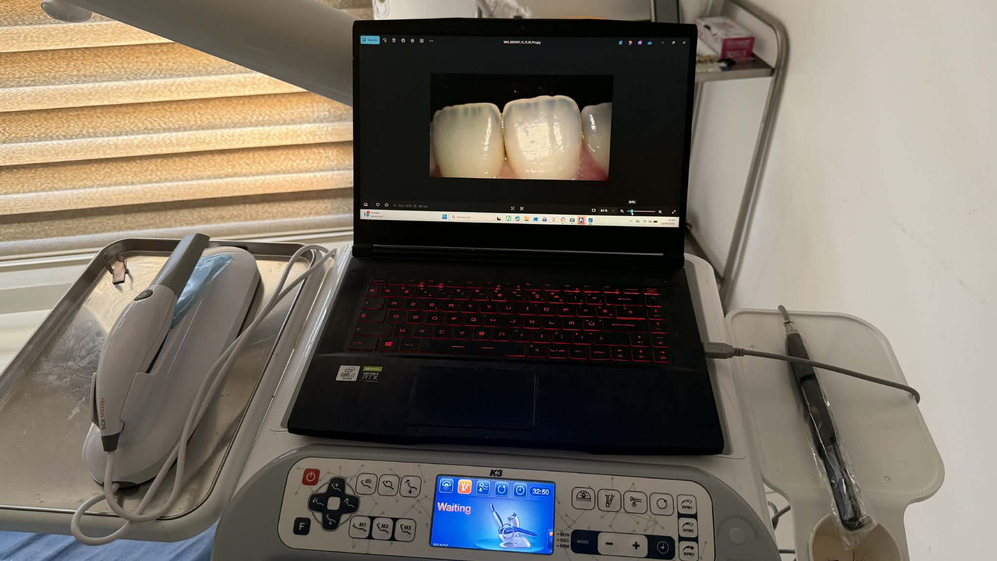 Blanchiment dentaire