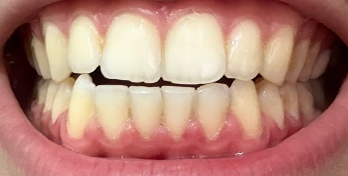 Yasin Mk review photo 2