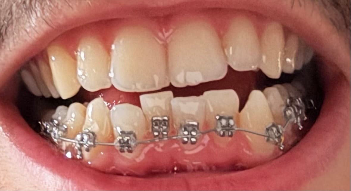 Yasin Mk review photo 1